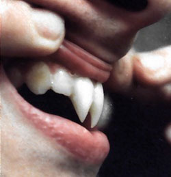 denti